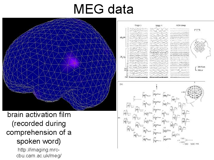 MEG data brain activation film (recorded during comprehension of a spoken word) http: //imaging.
