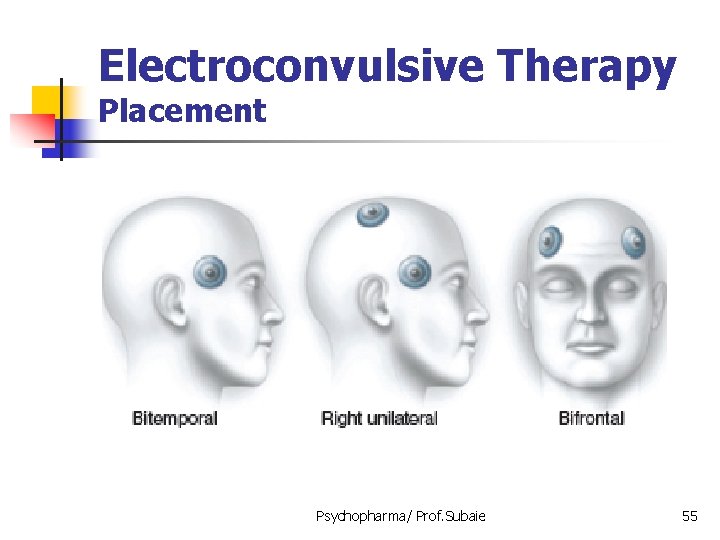 Electroconvulsive Therapy Placement Psychopharma/ Prof. Subaie 55 