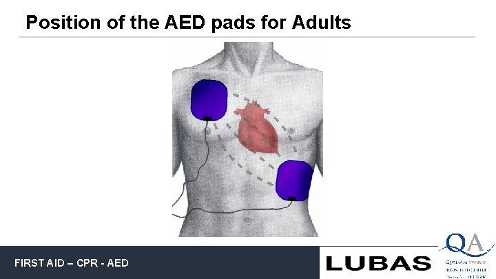 Position of the AED pads for Adults FIRST AID – CPR - AED 