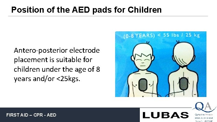 Position of the AED pads for Children Antero-posterior electrode placement is suitable for children