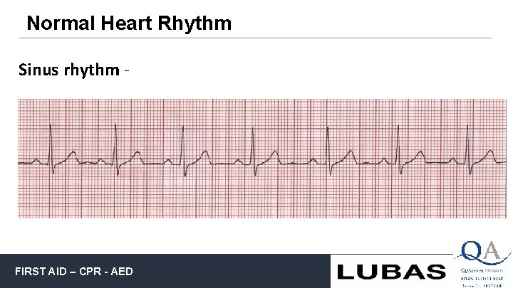 Normal Heart Rhythm Sinus rhythm - FIRST AID – CPR - AED 