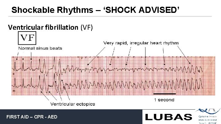 Shockable Rhythms – ‘SHOCK ADVISED’ Ventricular fibrillation (VF) FIRST AID – CPR - AED