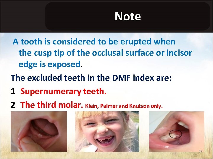 Note A tooth is considered to be erupted when the cusp tip of the