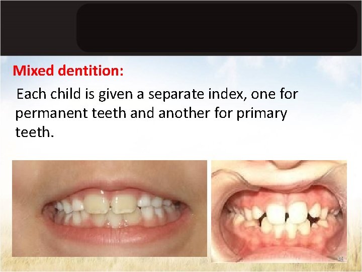 Mixed dentition: Each child is given a separate index, one for permanent teeth and