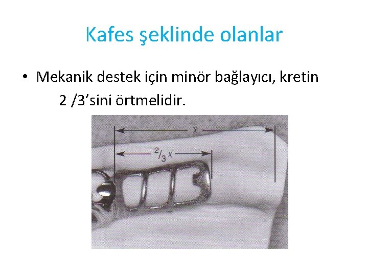 Kafes şeklinde olanlar • Mekanik destek için minör bağlayıcı, kretin 2 /3’sini örtmelidir. 