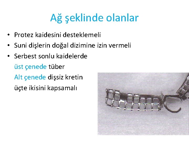 Ağ şeklinde olanlar • Protez kaidesini desteklemeli • Suni dişlerin doğal dizimine izin vermeli