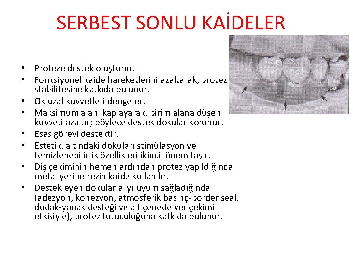 SERBEST SONLU KAİDELER • Proteze destek oluşturur. • Fonksiyonel kaide hareketlerini azaltarak, protez stabilitesine