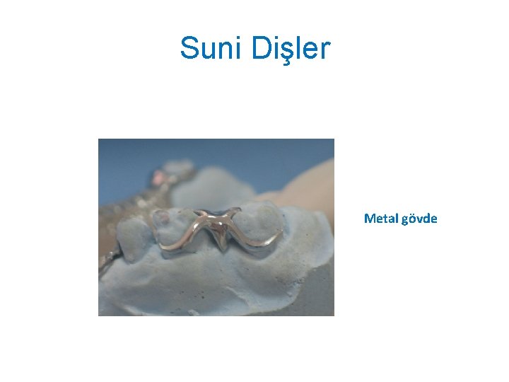 Suni Dişler Metal gövde 