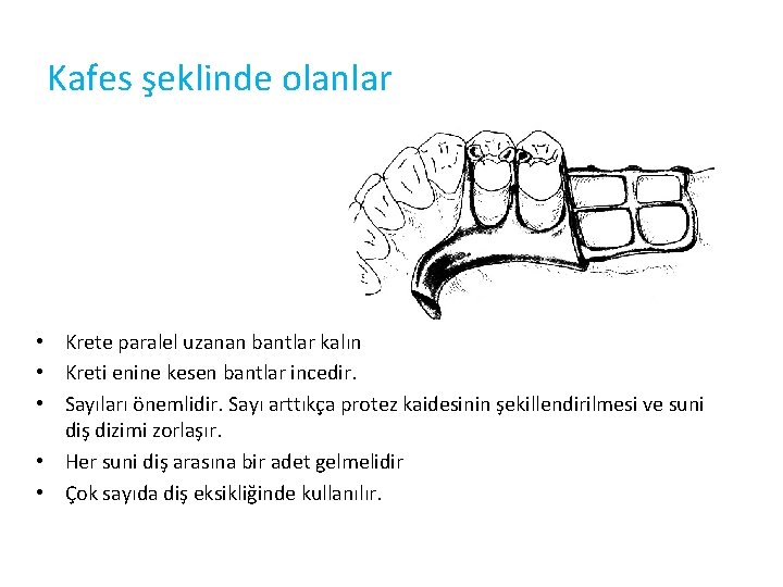 Kafes şeklinde olanlar • Krete paralel uzanan bantlar kalın • Kreti enine kesen bantlar