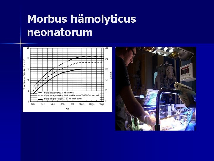 Morbus hämolyticus neonatorum Morbus hämolyticus neonatorum