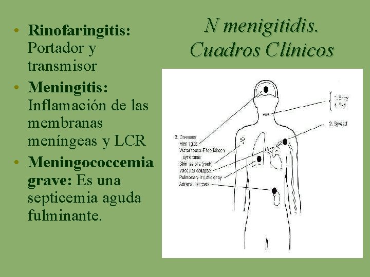  • Rinofaringitis: Portador y transmisor • Meningitis: Inflamación de las membranas meníngeas y