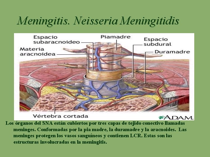Meningitis. Neisseria Meningitidis Los órganos del SNA están cubiertos por tres capas de tejido