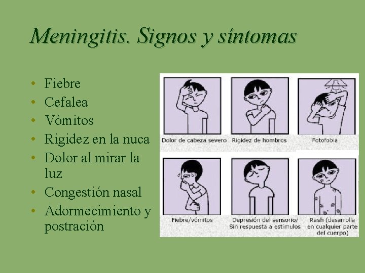 Meningitis. Signos y síntomas • • • Fiebre Cefalea Vómitos Rigidez en la nuca