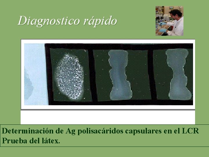 Diagnostico rápido Determinación de Ag polisacáridos capsulares en el LCR Prueba del látex. 