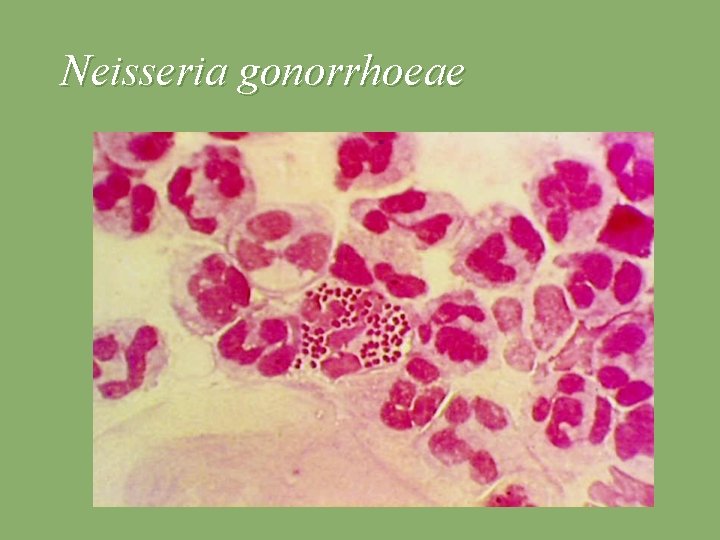 Neisseria gonorrhoeae 