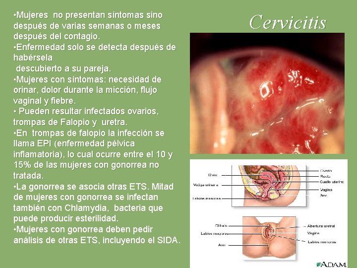  • Mujeres no presentan síntomas sino después de varias semanas o meses después
