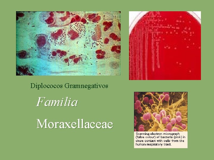 Diplococos Gramnegativos Familia Moraxellaceae 