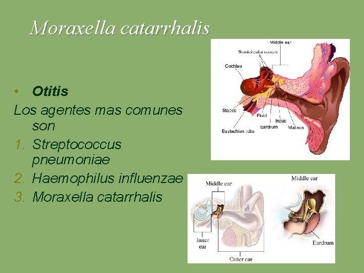 Moraxella catarrhalis • Otitis Los agentes mas comunes son 1. Streptococcus pneumoniae 2. Haemophilus