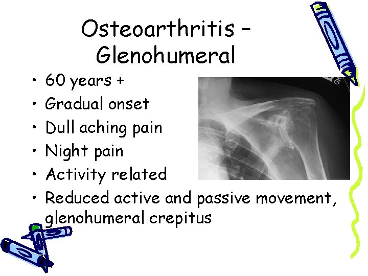  • • • Osteoarthritis – Glenohumeral 60 years + Gradual onset Dull aching