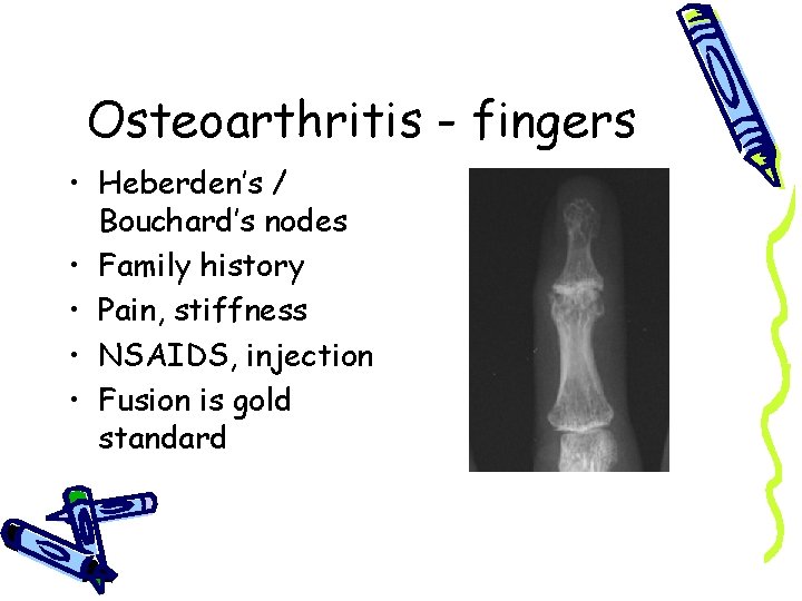 Osteoarthritis - fingers • Heberden’s / Bouchard’s nodes • Family history • Pain, stiffness