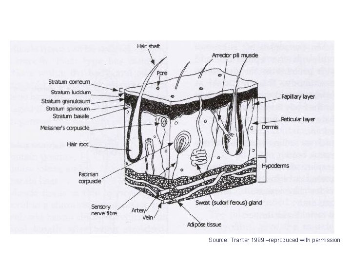 Source: Tranter 1999 –reproduced with permission 