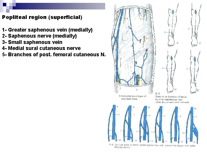 Popliteal region (superficial) 1 - Greater saphenous vein (medially) 2 - Saphenous nerve (medially)