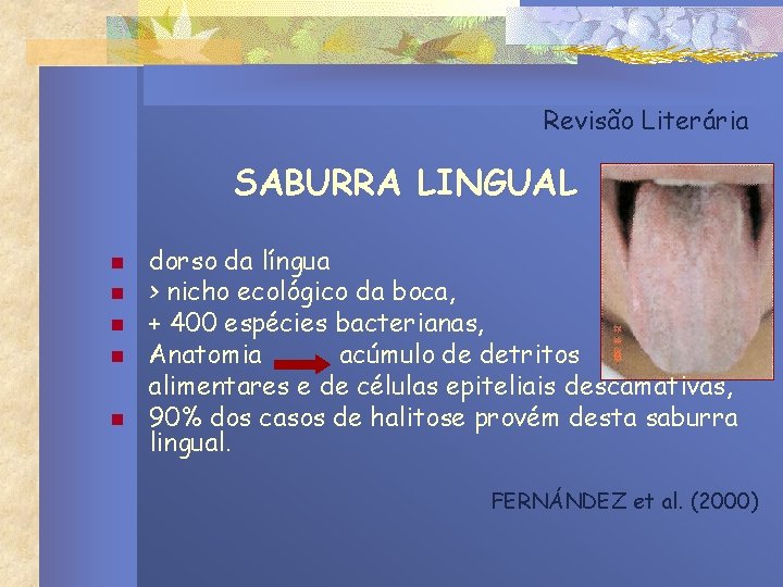 Revisão Literária SABURRA LINGUAL n n n dorso da língua > nicho ecológico da