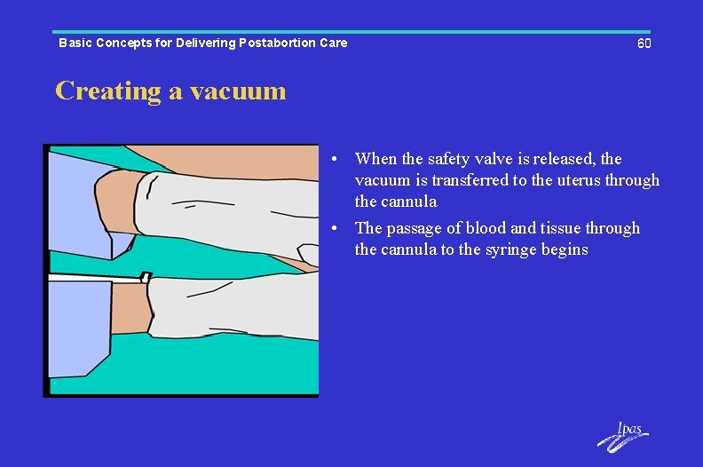 Basic Concepts for Delivering Postabortion Care 60 Creating a vacuum • When the safety