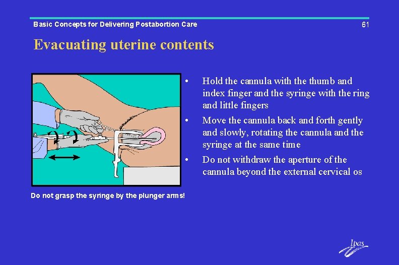 Basic Concepts for Delivering Postabortion Care 61 Evacuating uterine contents • • • Do
