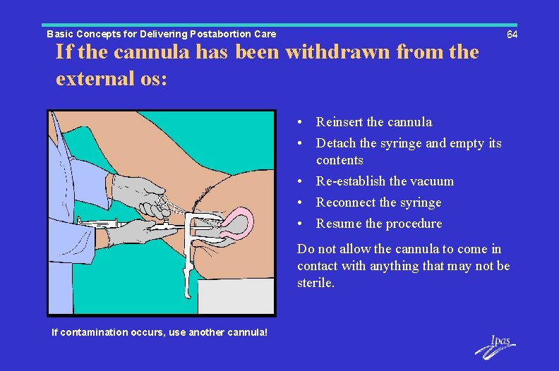 Basic Concepts for Delivering Postabortion Care If the cannula has been withdrawn from the