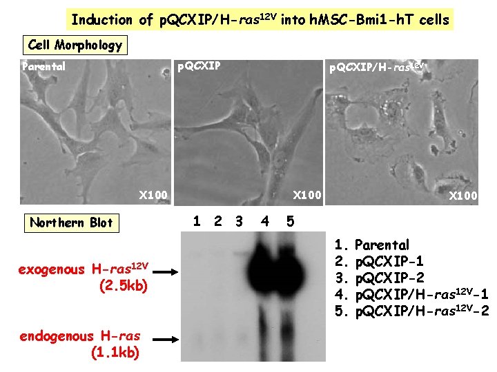 Induction of p. QCXIP/H-ras 12 V into h. MSC-Bmi 1 -h. T cells Cell