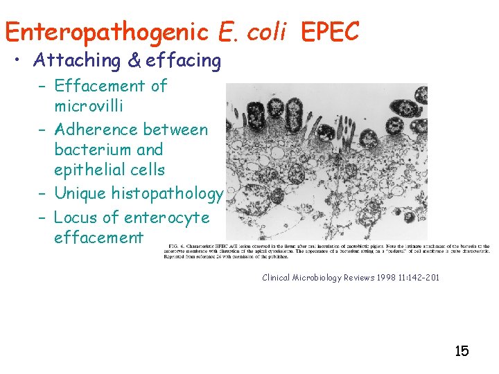 Enteropathogenic E. coli EPEC • Attaching & effacing – Effacement of microvilli – Adherence