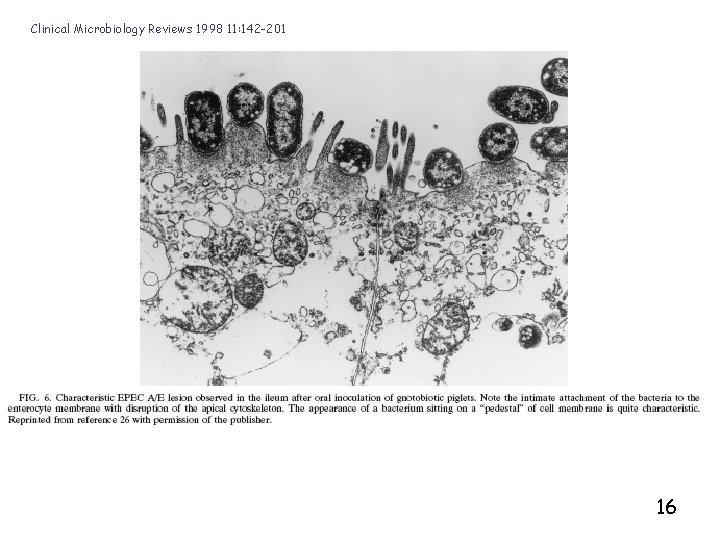 Clinical Microbiology Reviews 1998 11: 142 -201 16 