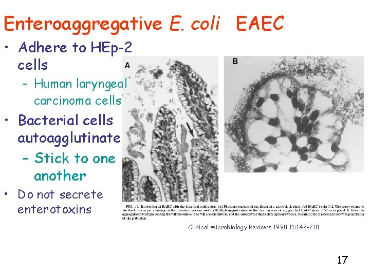 Enteroaggregative E. coli EAEC • Adhere to HEp-2 cells – Human laryngeal carcinoma cells