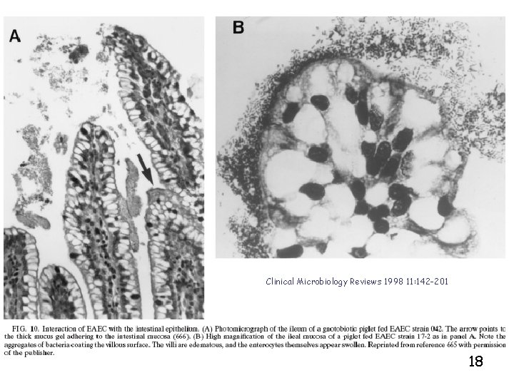 Clinical Microbiology Reviews 1998 11: 142 -201 18 