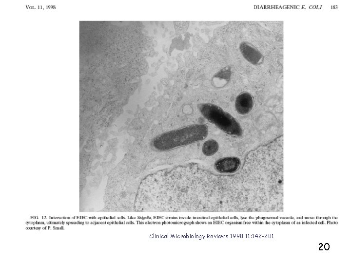 Clinical Microbiology Reviews 1998 11: 142 -201 20 