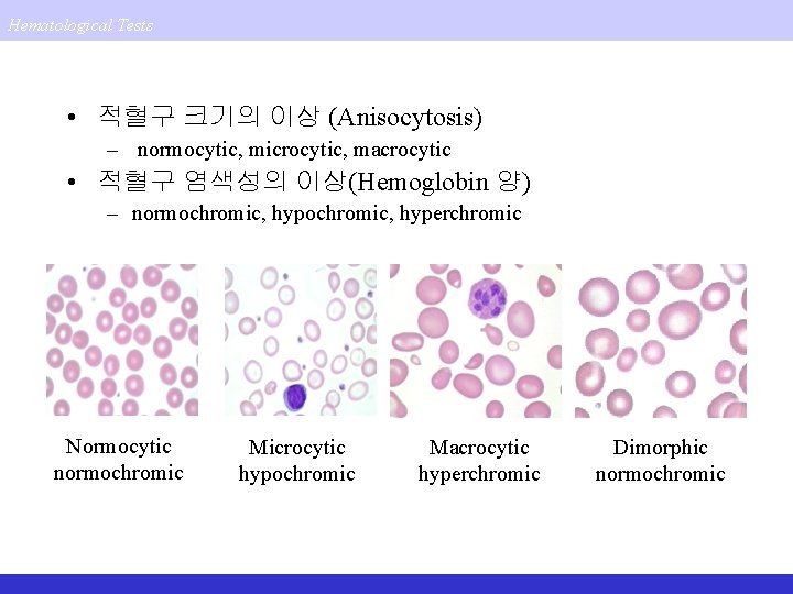 Hematological Tests • 적혈구 크기의 이상 (Anisocytosis) – normocytic, microcytic, macrocytic • 적혈구 염색성의