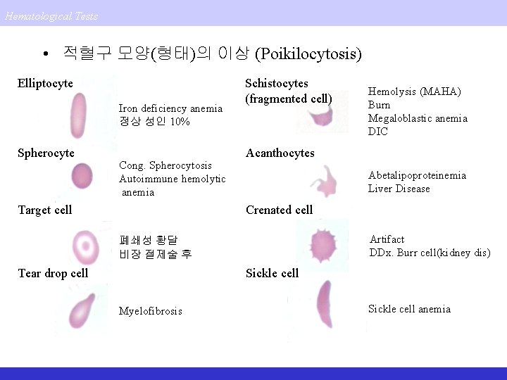 Hematological Tests • 적혈구 모양(형태)의 이상 (Poikilocytosis) Elliptocyte Iron deficiency anemia 정상 성인 10%