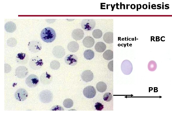 Erythropoiesis Normoblast BM Reticulocyte RBC PB 