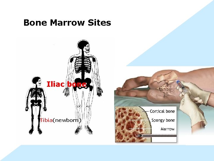 Bone Marrow Sites Iliac bone Tibia(newborn) 