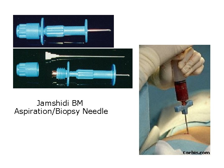 Jamshidi BM Aspiration/Biopsy Needle 