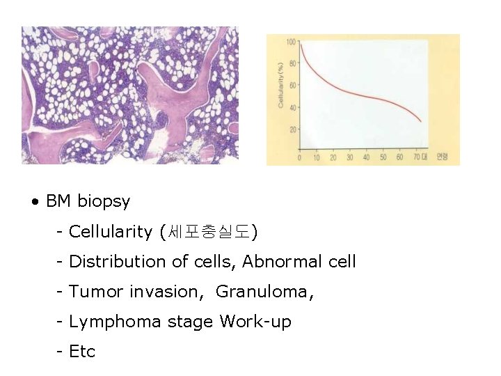  • BM biopsy - Cellularity (세포충실도) - Distribution of cells, Abnormal cell -