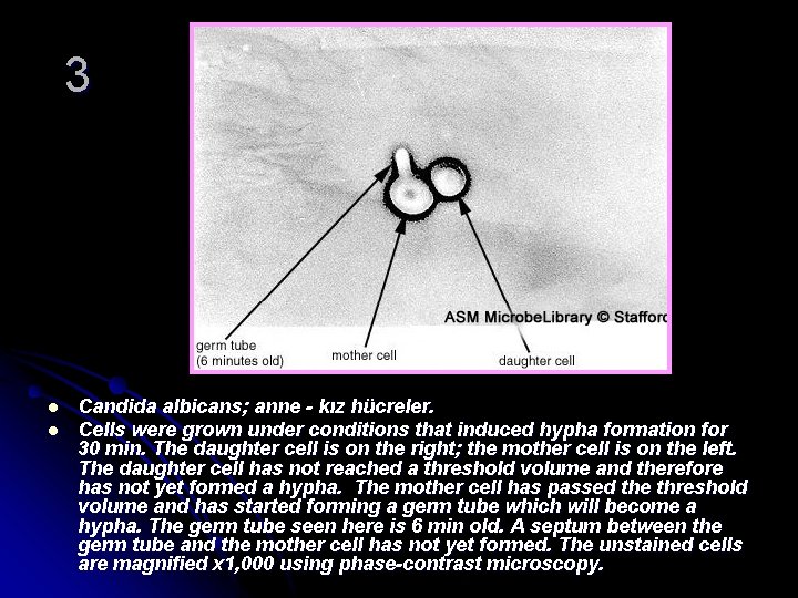 3 l l Candida albicans; anne - kız hücreler. Cells were grown under conditions