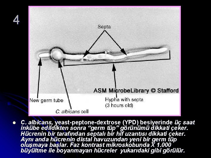 4 l C. albicans, yeast-peptone-dextrose (YPD) besiyerinde üç saat inkübe edildikten sonra “germ tüp”