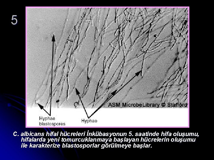 5 C. albicans hifal hücreleri İnkübasyonun 5. saatinde hifa oluşumu, hifalarda yeni tomurcuklanmaya başlayan