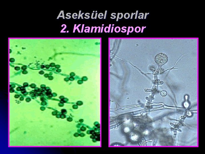 Aseksüel sporlar 2. Klamidiospor 