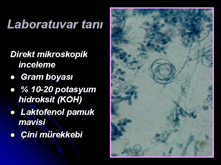 Laboratuvar tanı Direkt mikroskopik inceleme l Gram boyası l % 10 -20 potasyum hidroksit