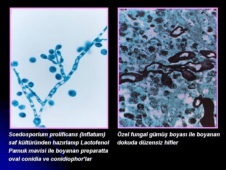 Scedosporium prolificans (inflatum) saf kültüründen hazırlanıp Lactofenol Pamuk mavisi ile boyanan preparatta oval conidia