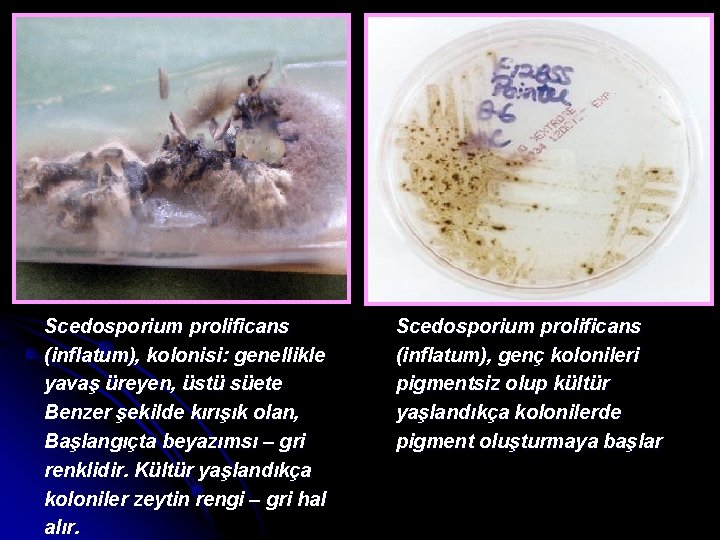 Scedosporium prolificans (inflatum), kolonisi: genellikle yavaş üreyen, üstü süete Benzer şekilde kırışık olan, Başlangıçta