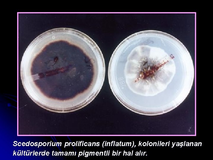 Scedosporium prolificans (inflatum), kolonileri yaşlanan kültürlerde tamamı pigmentli bir hal alır. 